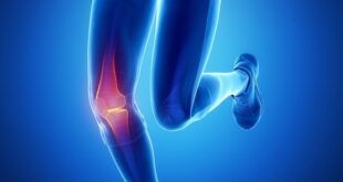 Cara Mengobati Cedera Ligamen Lutut dan Efeknya
